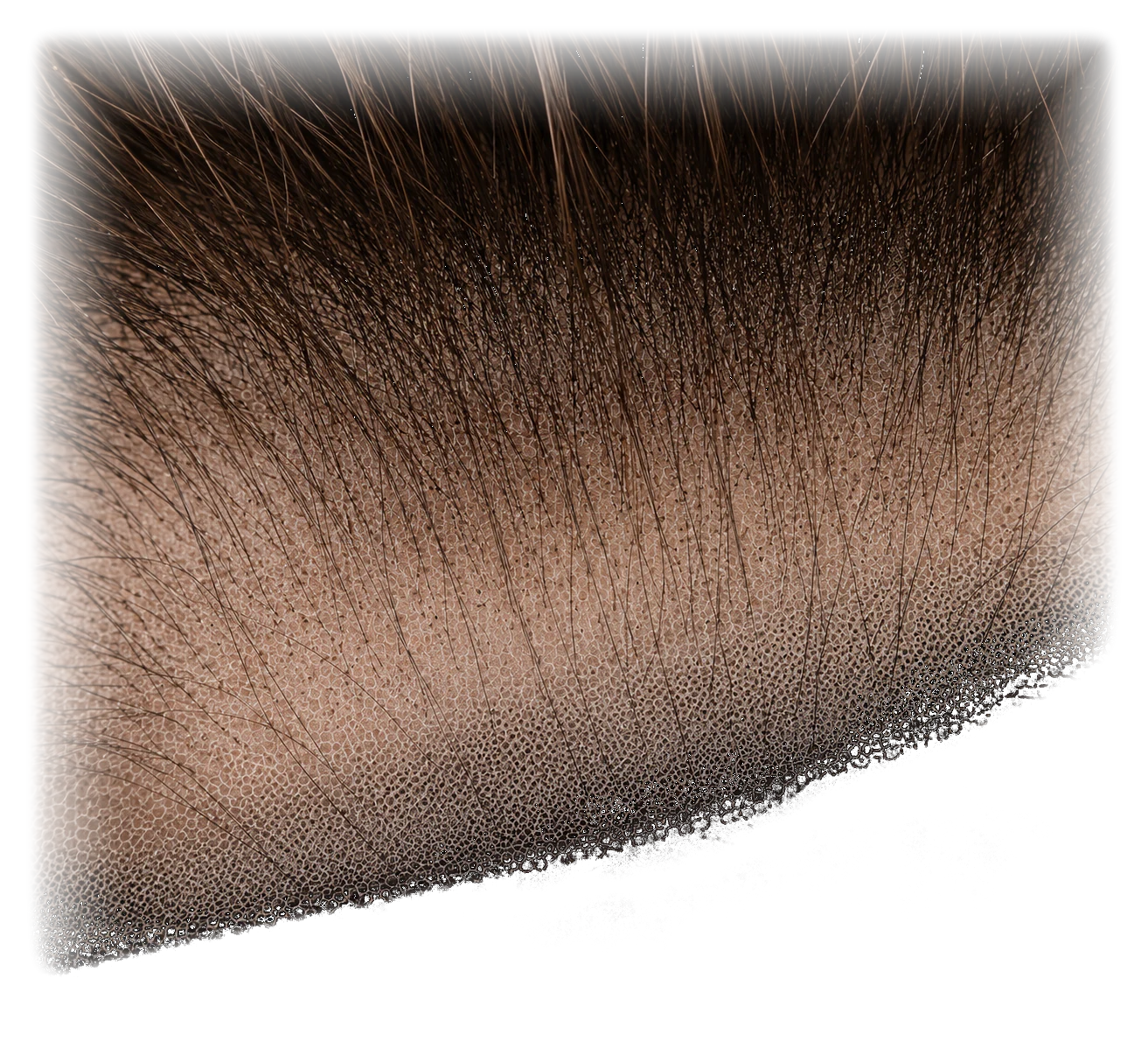 Hairline density gradient across the lace depth